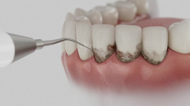 Trusted Dental Crowns And Bridges service in Helena, MT - Dentist Open Now